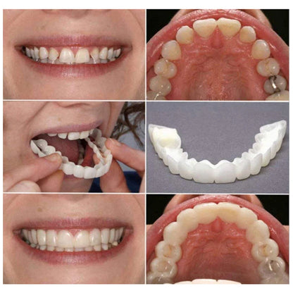 Carillas Dentales Removibles Ajustables – Sonrisa Perfecta en Minutos [Pagás 1 y Llevás 4]